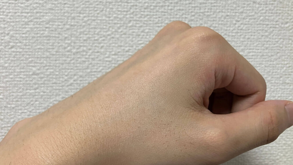 若干肌全体が明るく見える程度